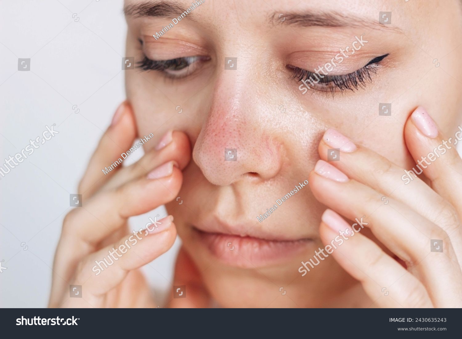 stock-photo-sunburn-redness-of-the-nose-young-woman-worried-about-her-red-skin-of-the-nose-isolated-on-white-2430635243